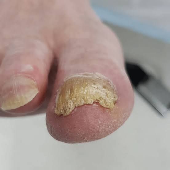 Foot and nail care illustration