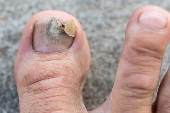 Foot and nail care illustration