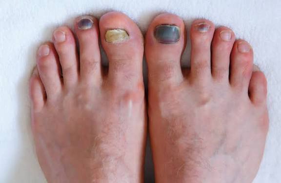Foot and nail care illustration