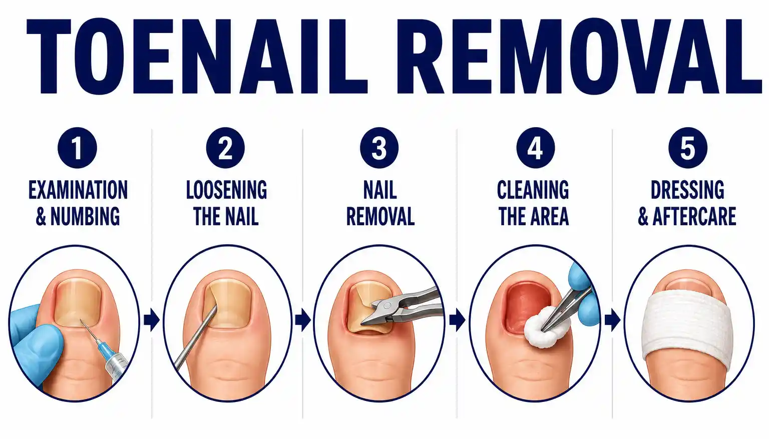 Foot and nail care illustration