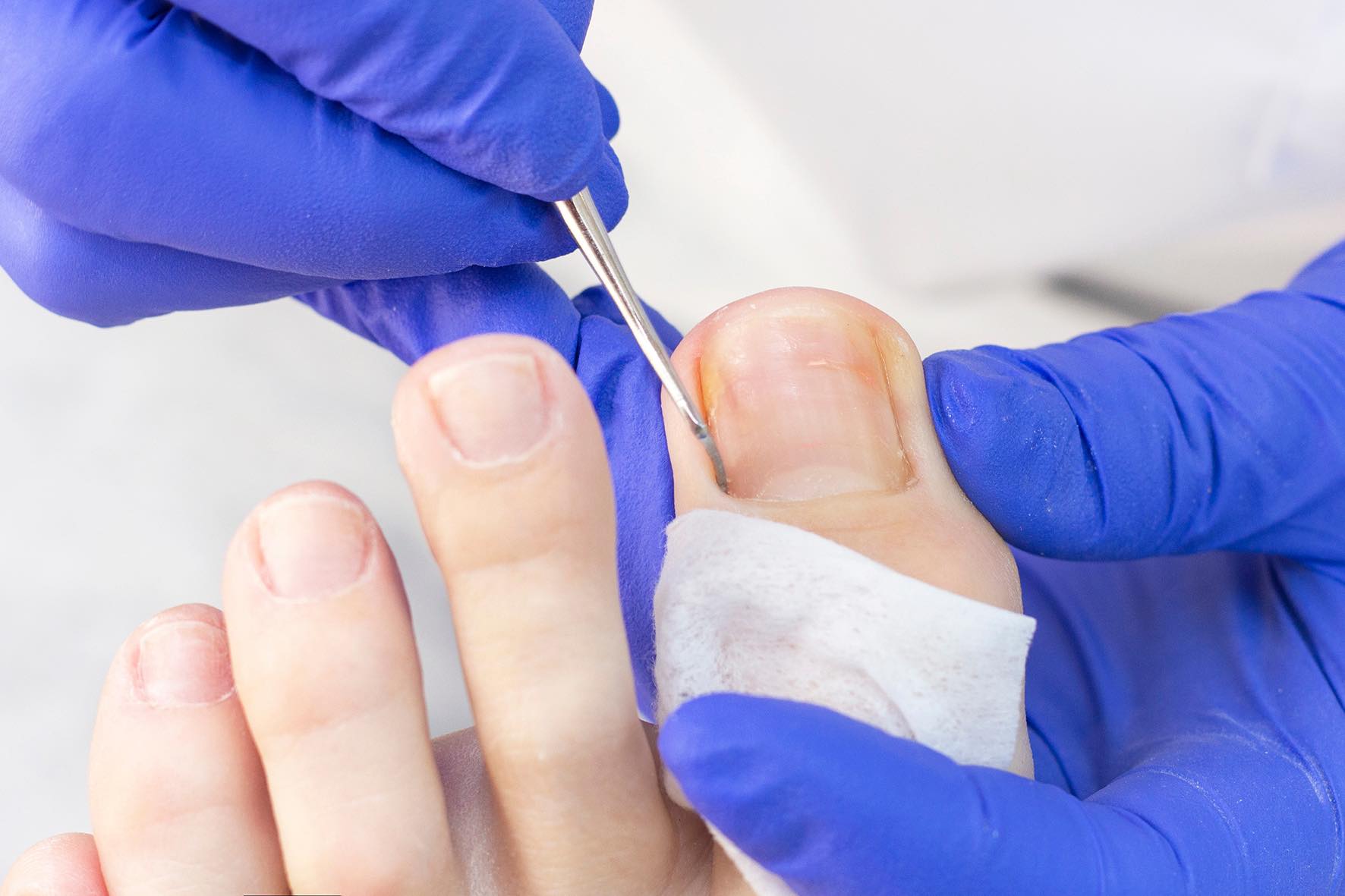 Foot and nail care illustration