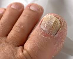 Foot and nail care illustration