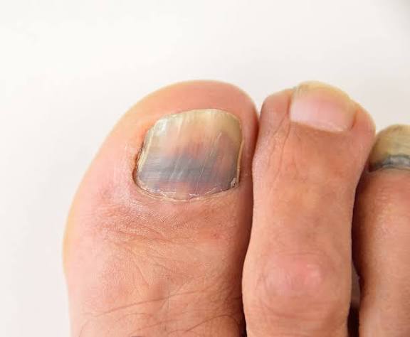 Foot and nail care illustration
